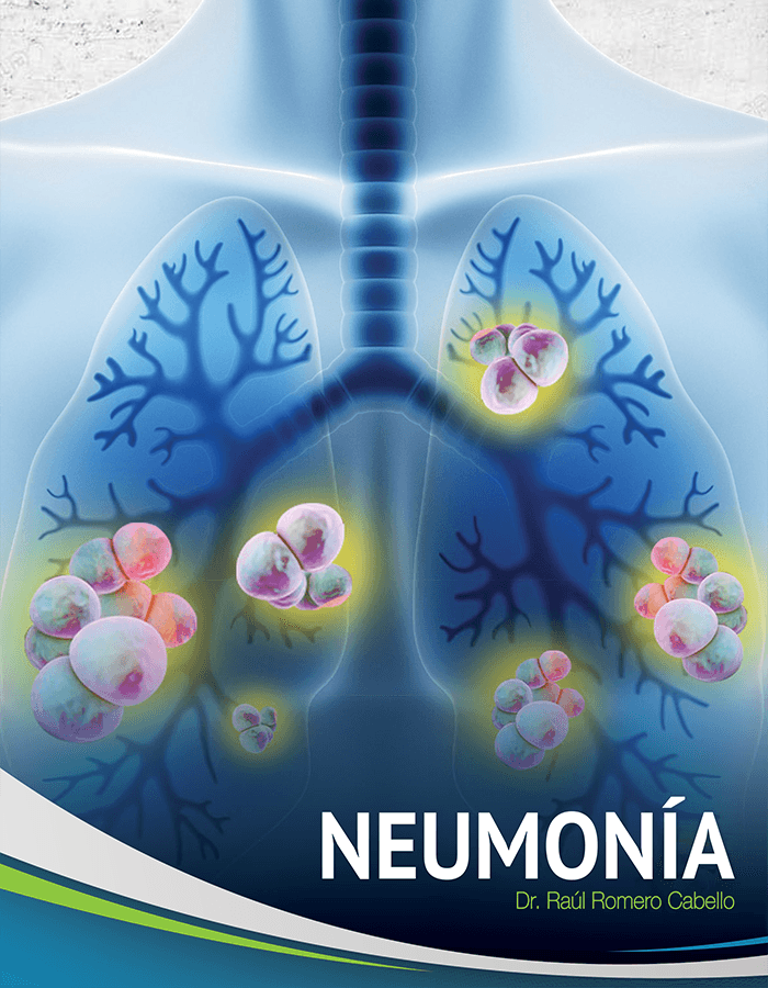  Neumonia